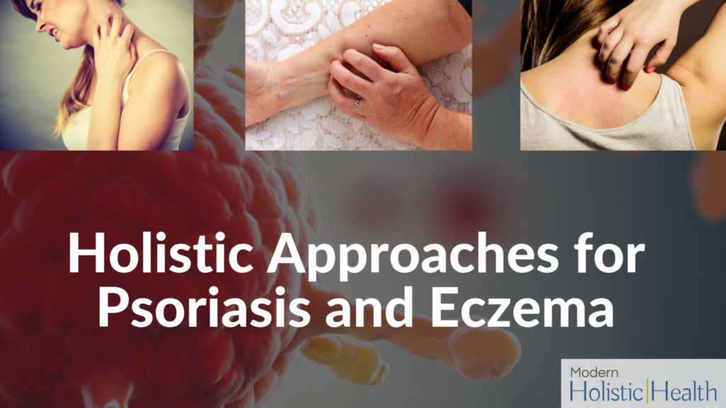 Holistic approaches for psoriasis and eczema (1)