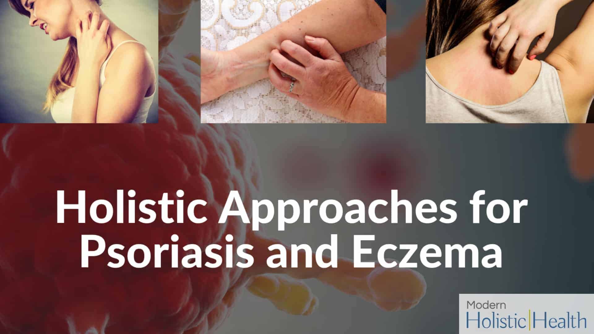 Holistic approaches for psoriasis and eczema (1)