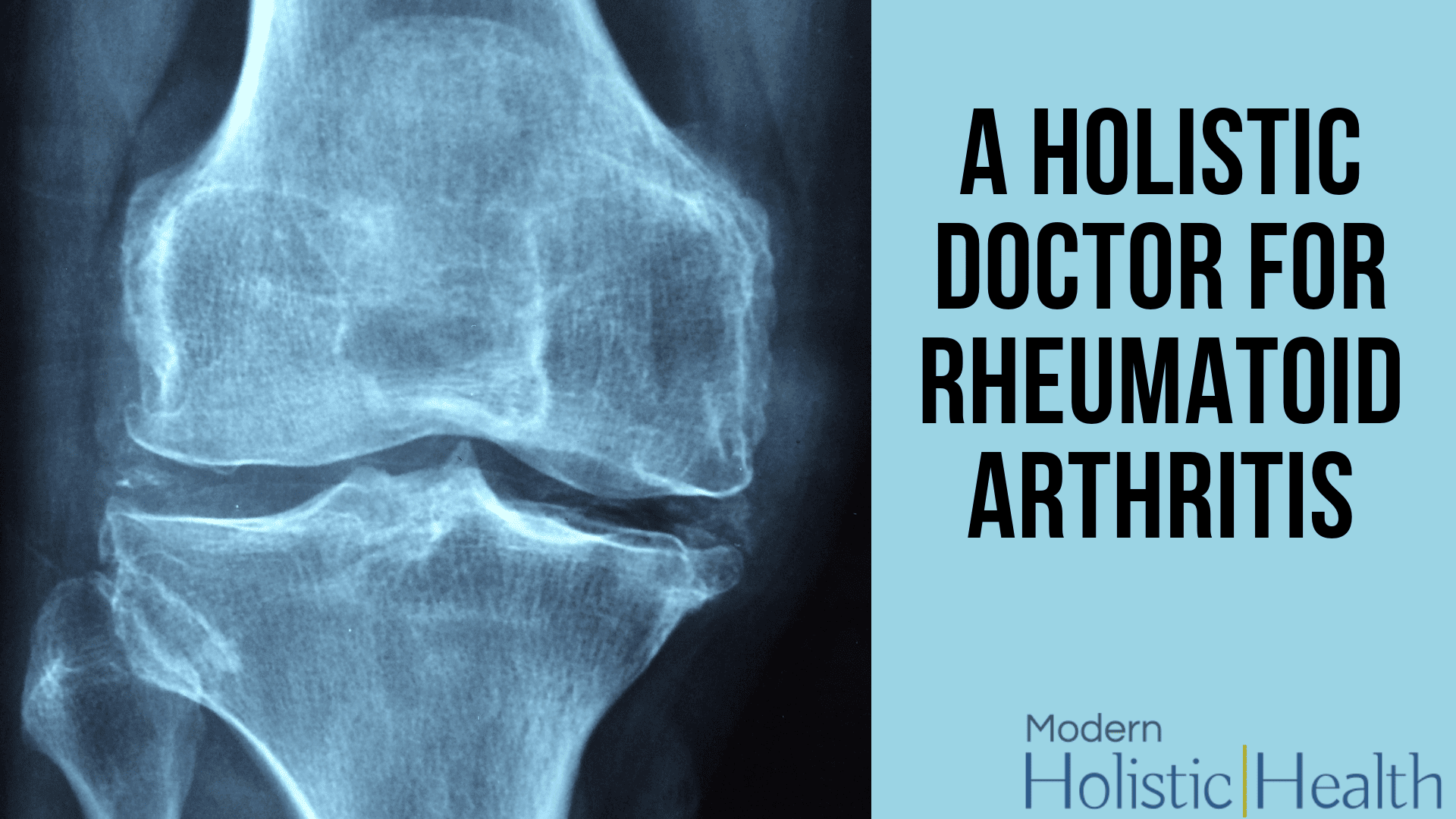Holistic doctor for Rheumatoid Arthritis