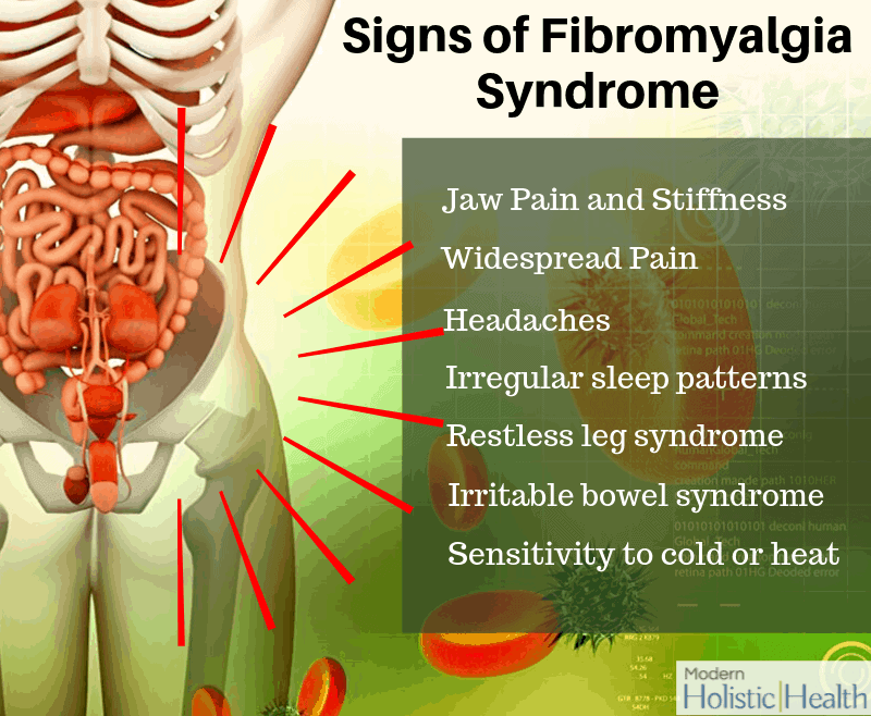 Fibromyalgia Syndrome1