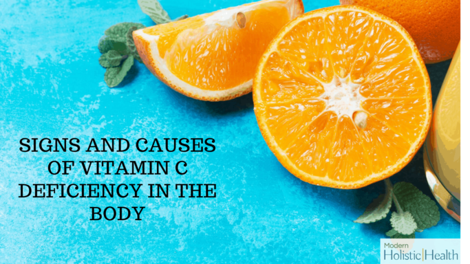 Vitamin C Deficiency3