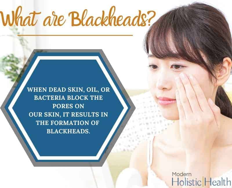 Blackhead Removal Solutions 2